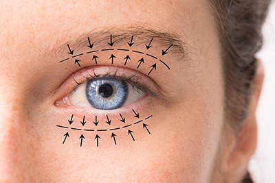 upper eyelid surgery cost New York, NY